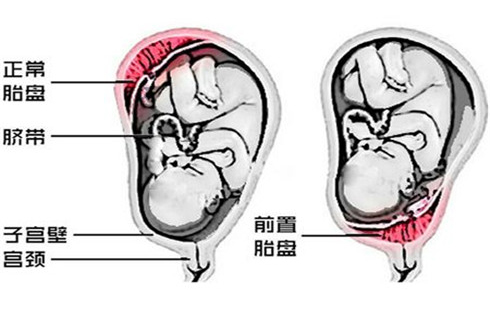 пʱ䣺ʲôǰ̥