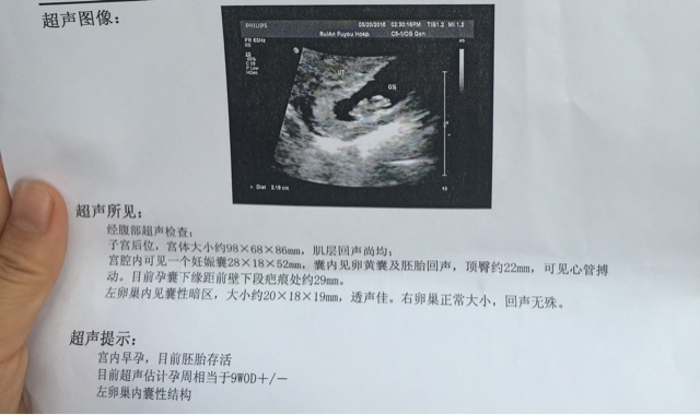 孕早期的B超数据怎么看 我们来告诉你